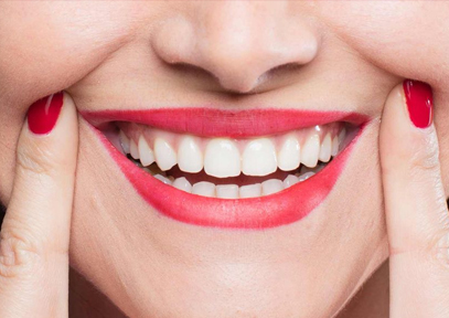 makeover treatment at avant dental clinic kolkata