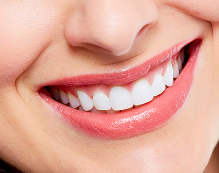makeover2 treatment at avant dental clinic kolkata