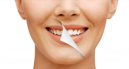 smile_makeover4 smile makeover at avant dental clinic kolkata