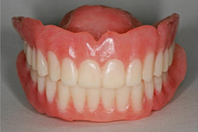 denture at avant dental clinic kolkata