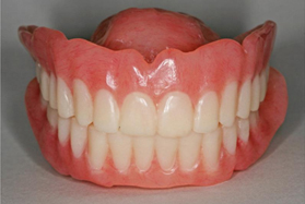 TD1 denture at avant dental clinic kolkata