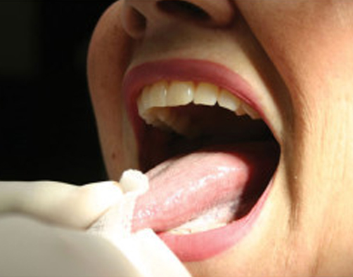 teeth treatment at avant dental clinic kolkata