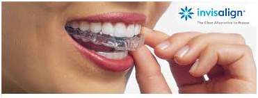 mouth guard at avant dental clinic kolkata