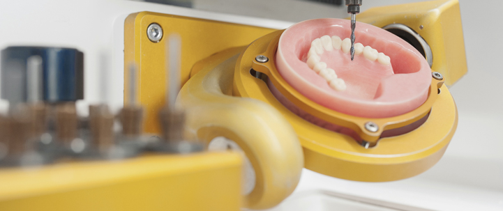 cad cad teeth at avant dental clinic kolkata