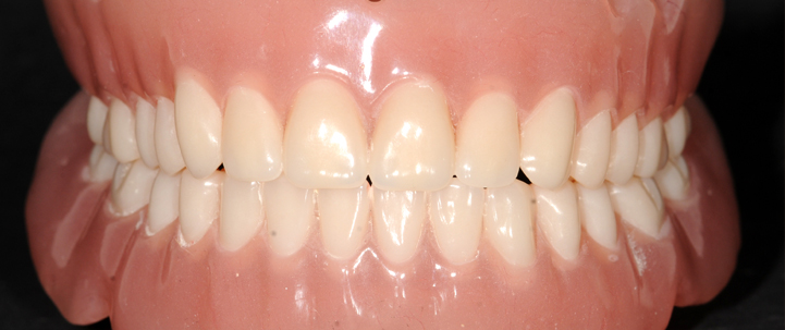 after treatment teeth at avant dental clinic kolkata