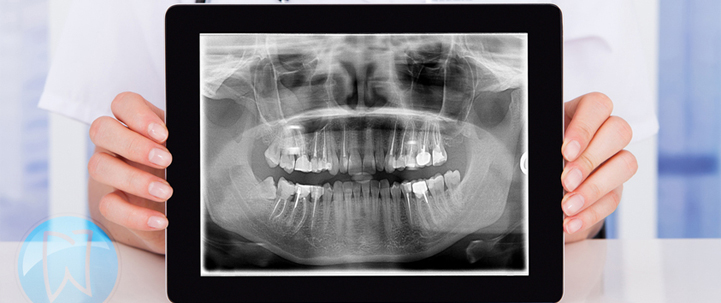 x ray report at avant dental clinic kolkata