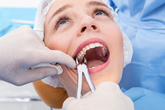 tooth extraction at avant dental clinic kolkata