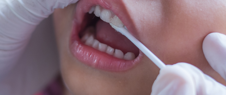 child teeth treatment at avant dental clinic kolkata