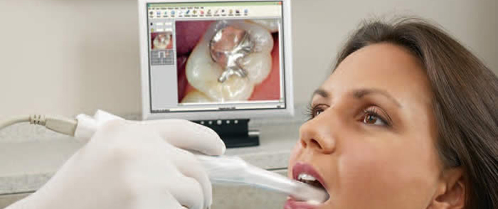 intra-oral-camera2 oral treatment at avant dental clinic kolkata