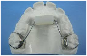 kjhghj habit breaking guard at avant dental clinic kolkata