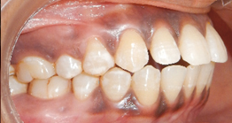 treatment at avant dental clinic kolkata