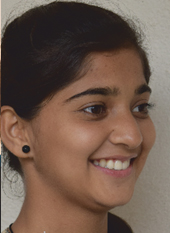 pre_treatment1 oral treatment at avant dental clinic kolkata