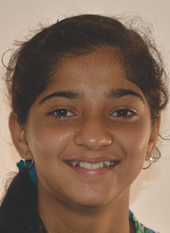 pre_treatment2 oral treatment at avant dental clinic kolkata