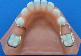 space3 space maintain treatment at avant dental clinic kolkata