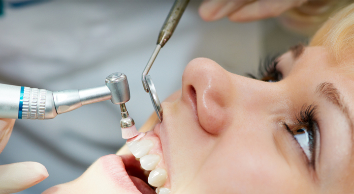 teeth cleaning at avant dental clinic kolkata