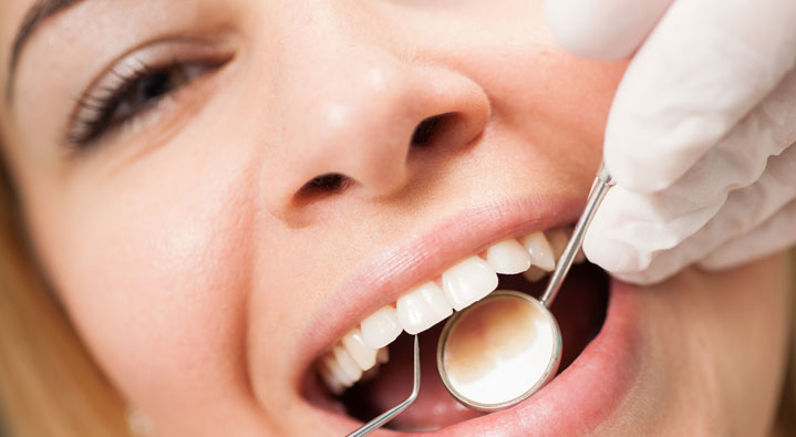 teeth cleaning at avant dental clinic kolkata