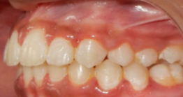 oral treatment a avant dental clinic kolkata