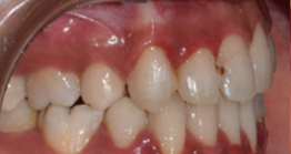 treatment at avant dental clinic kolkata