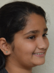 treatment7_7 after treatment at avant dental clinic kolkata